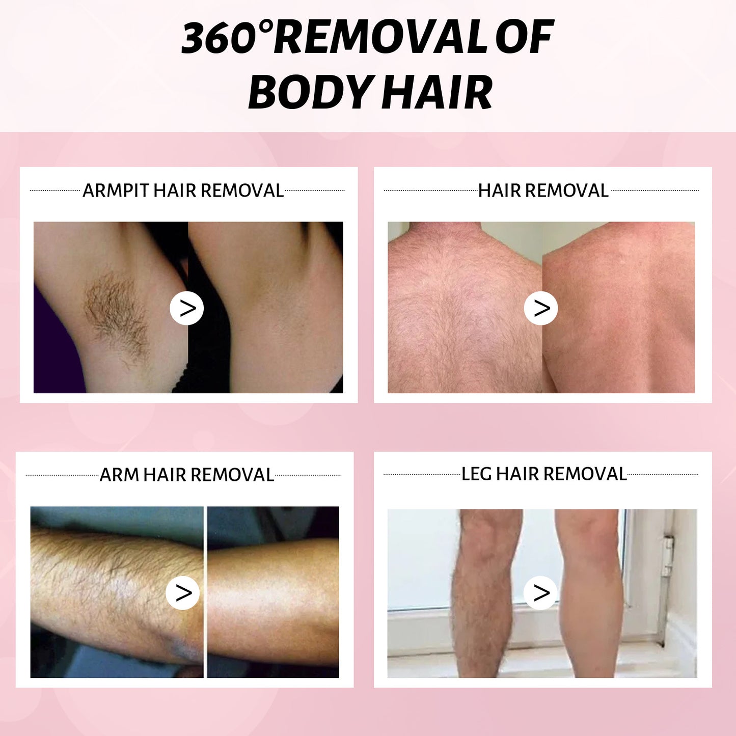 Hair removal cream, inhibiting hair growth from the source